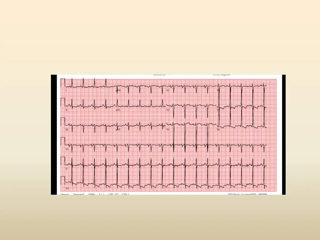 slide14