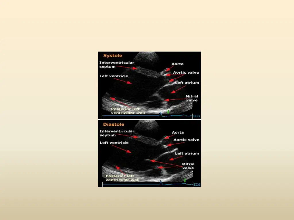 slide16