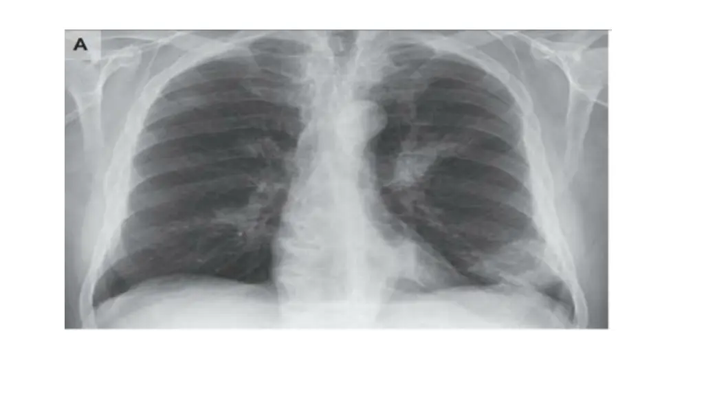 slide21