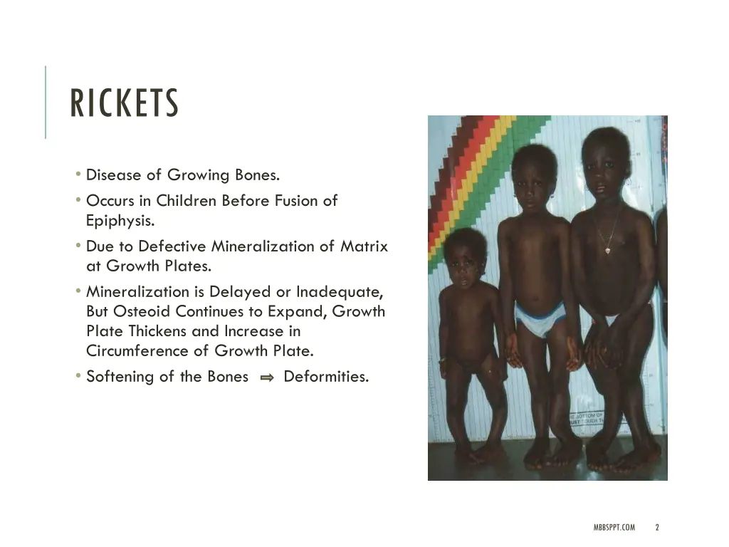 rickets