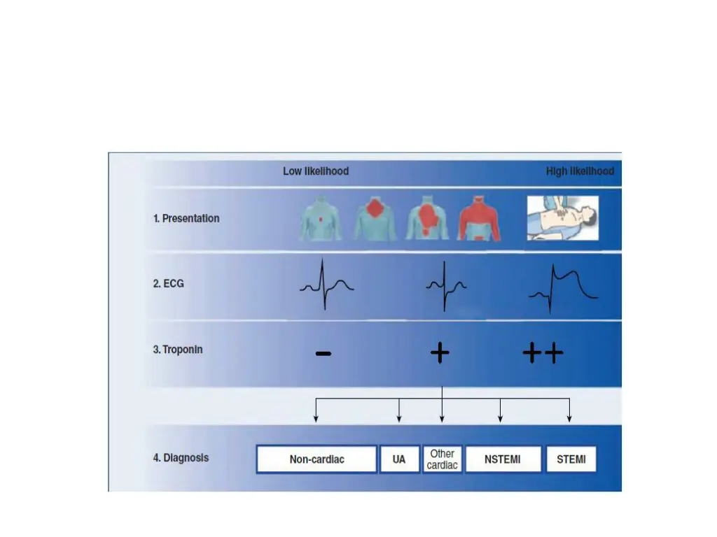 slide12
