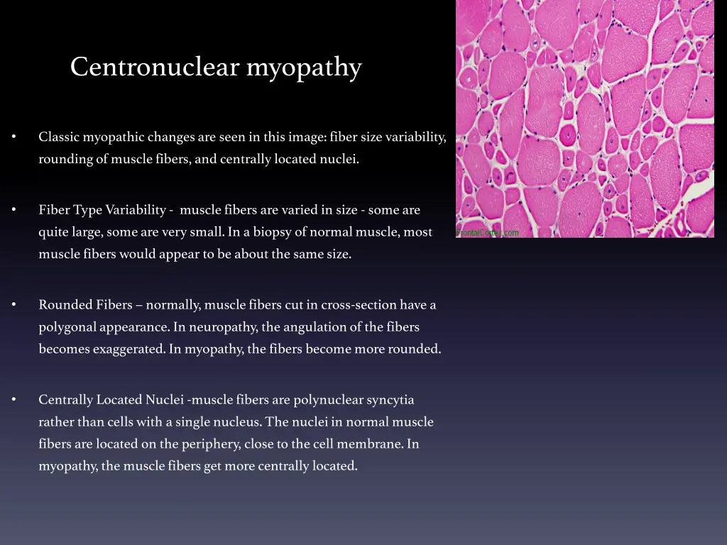 centronuclear myopathy