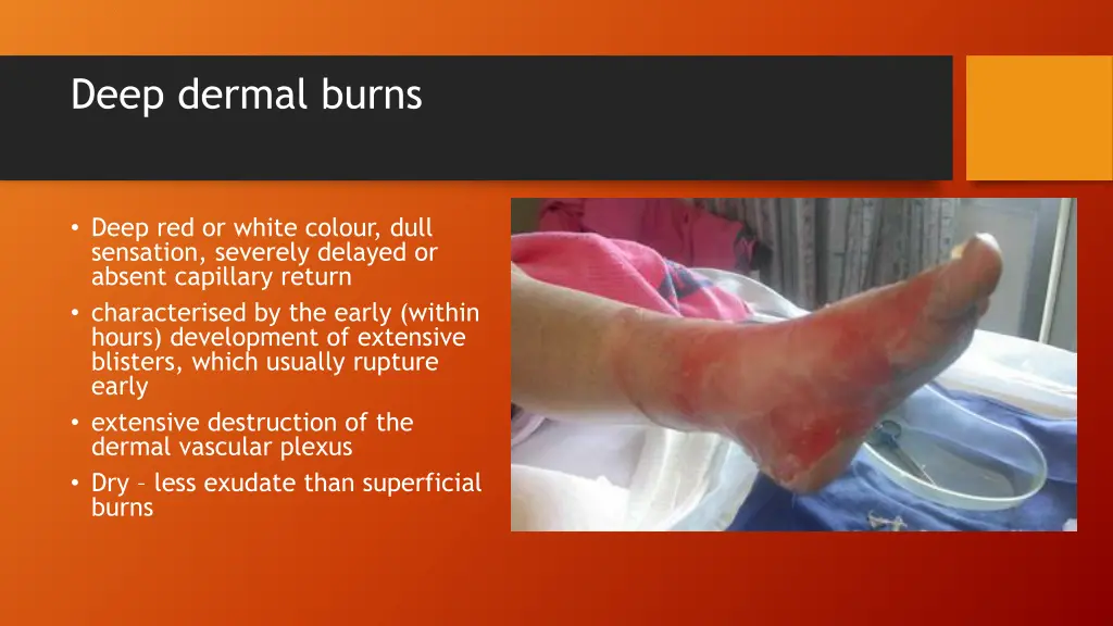 deep dermal burns