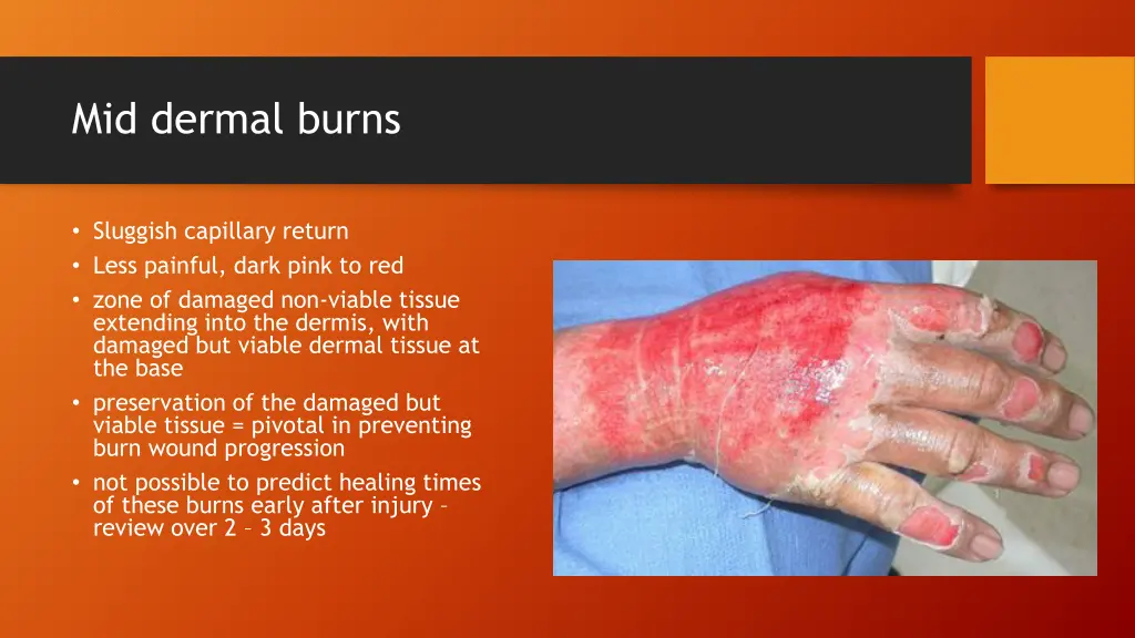 mid dermal burns