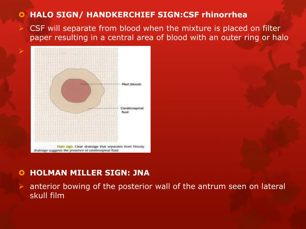 halo sign handkerchief sign csf rhinorrhea