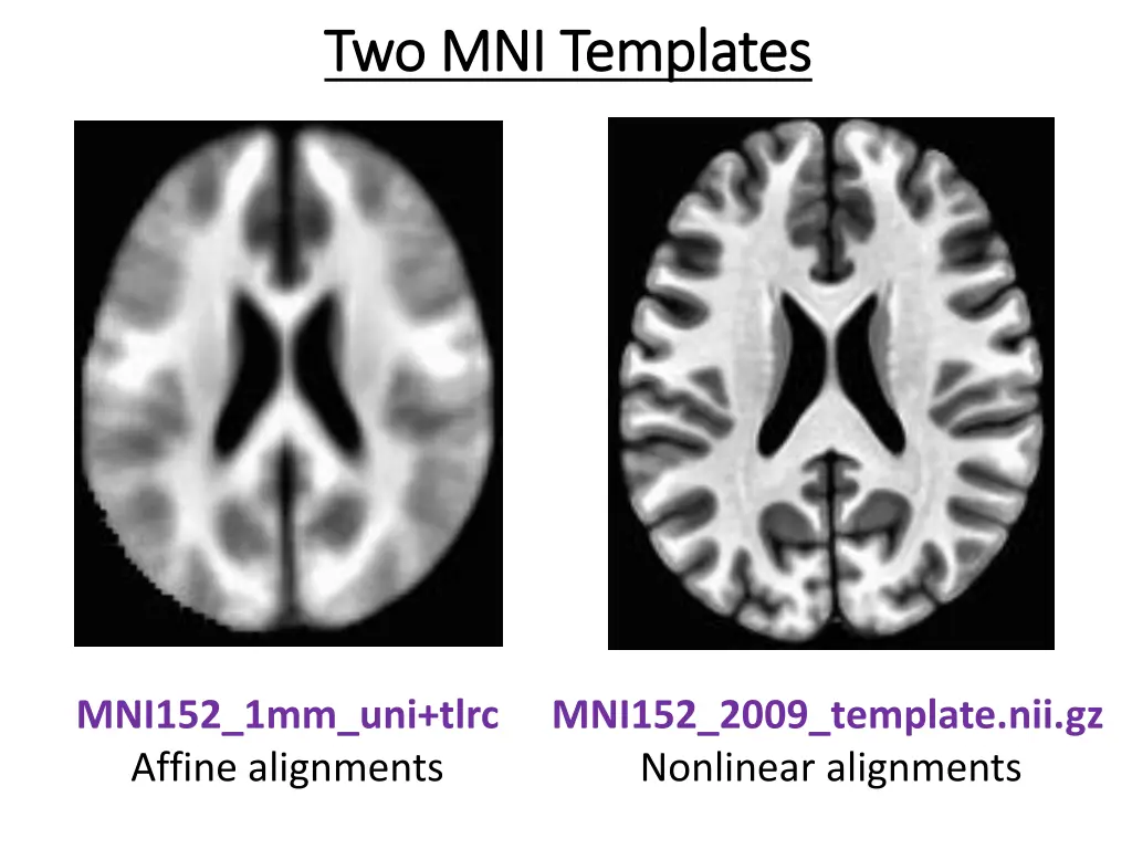 two mni templates two mni templates
