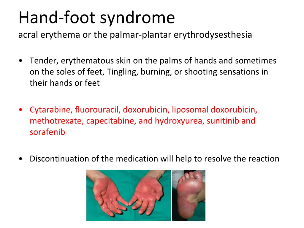 hand foot syndrome acral erythema or the palmar