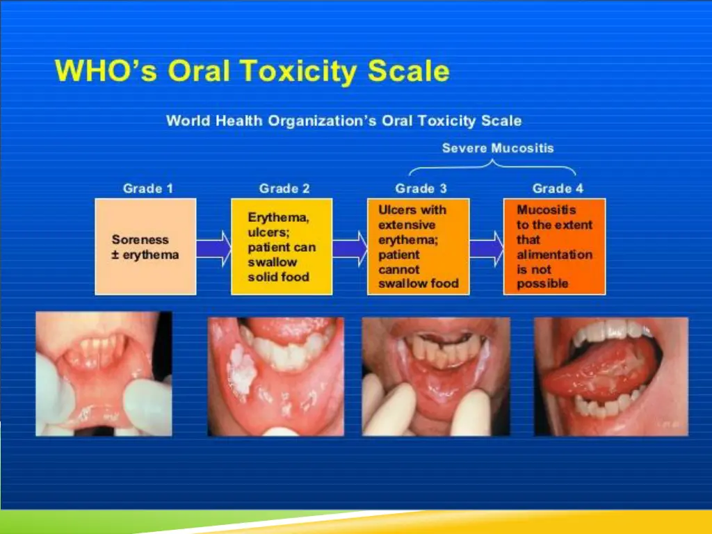 slide21