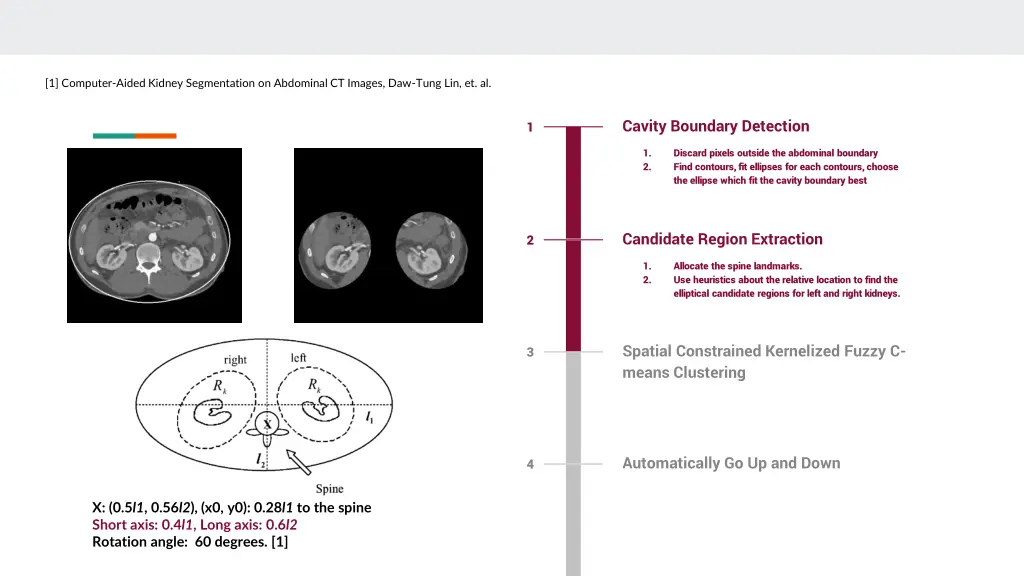 1 computer aided kidney segmentation on abdominal