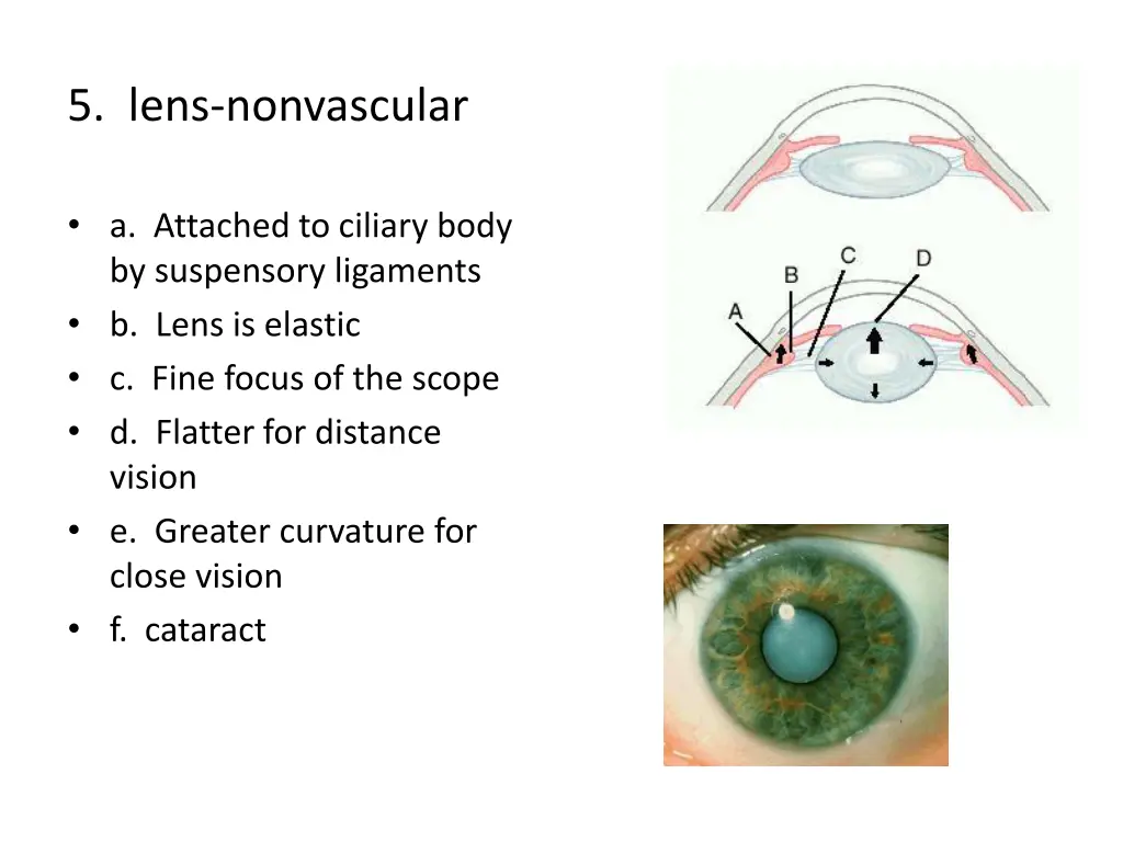 5 lens nonvascular