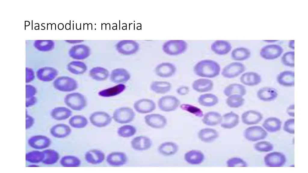 plasmodium malaria