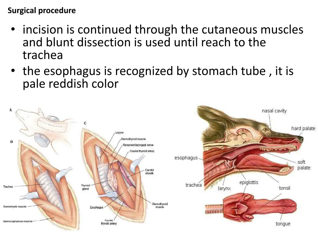surgical procedure 1