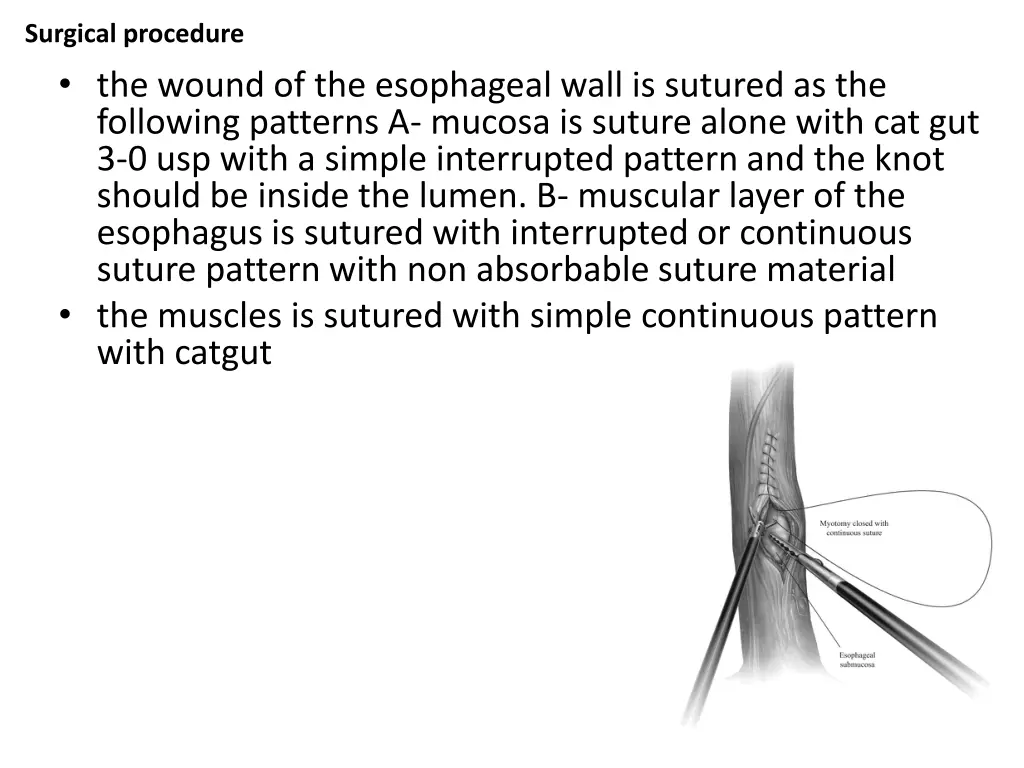 surgical procedure 3