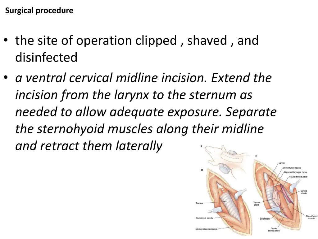 surgical procedure