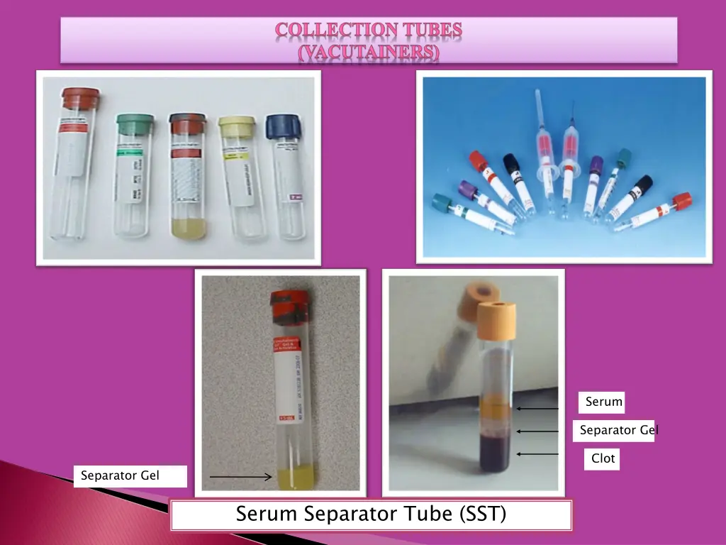 serum 1