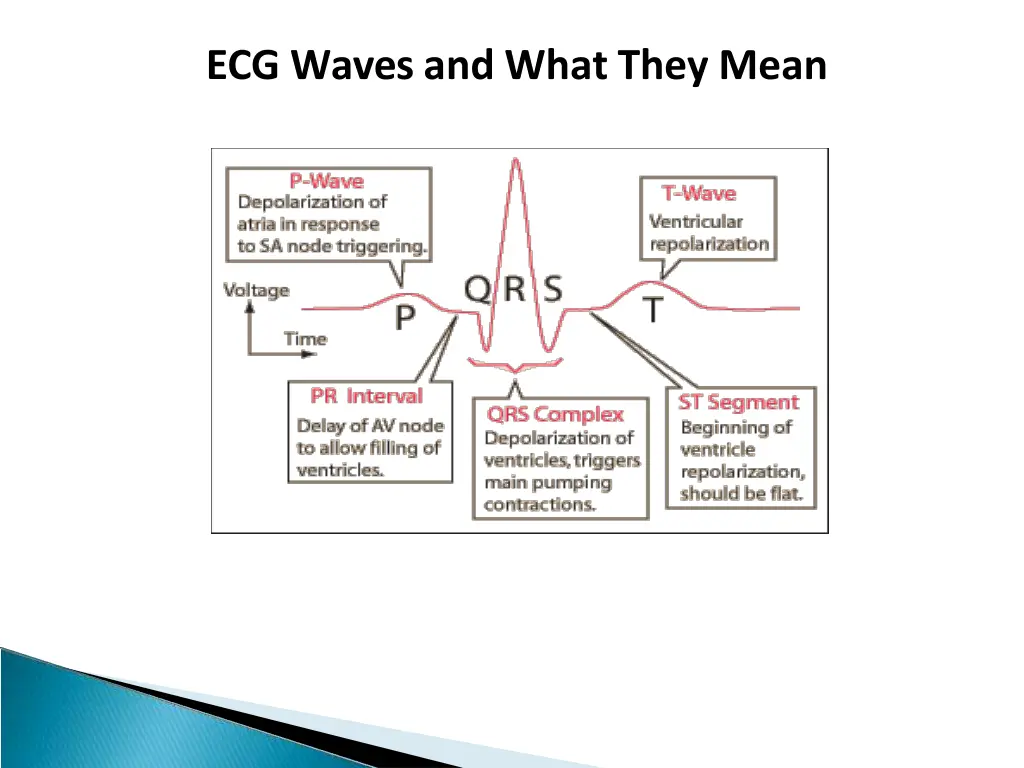 ecg waves and what they mean