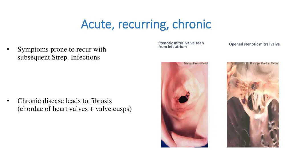 acute recurring acute recurring chronic