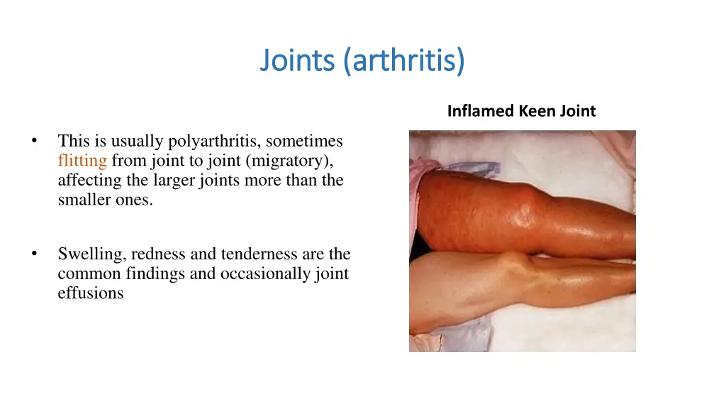 joints arthritis joints arthritis