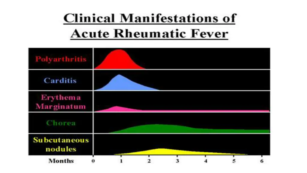 slide26