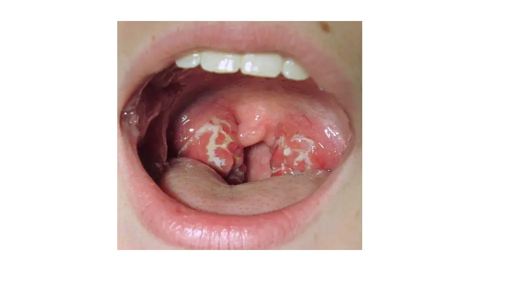 slide6