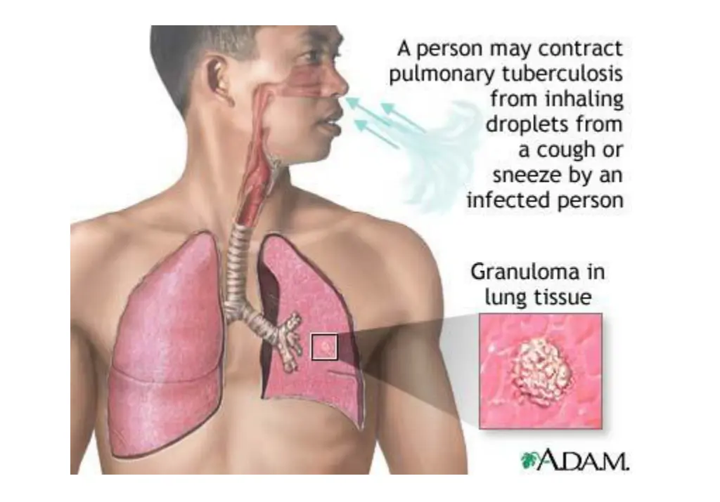 slide13