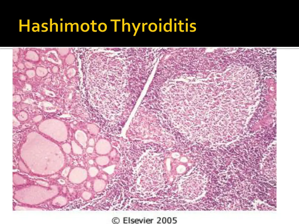 slide23