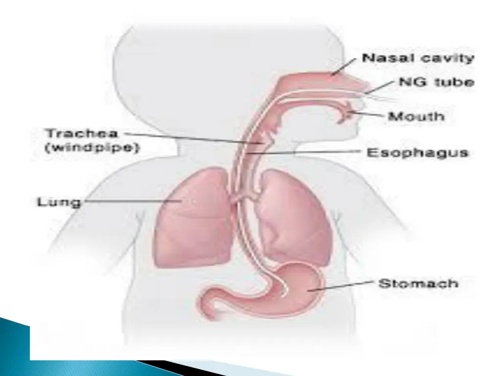 slide11