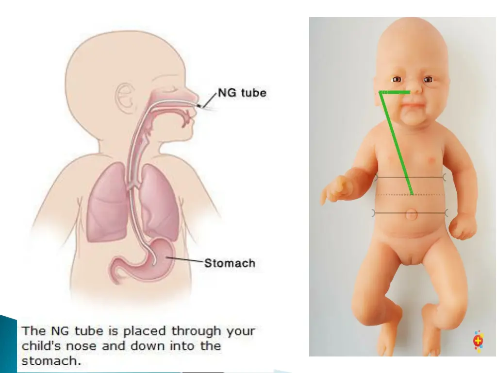 slide14