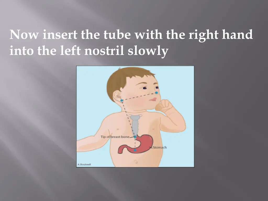 now insert the tube with the right hand into