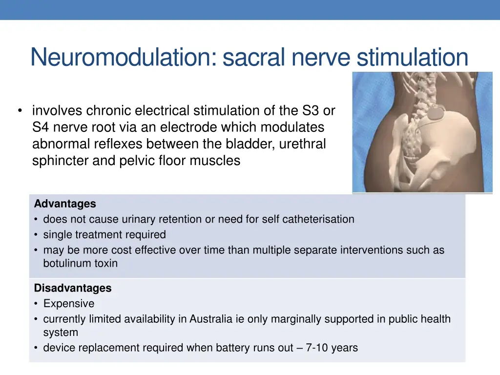 neuromodulation sacral nerve stimulation