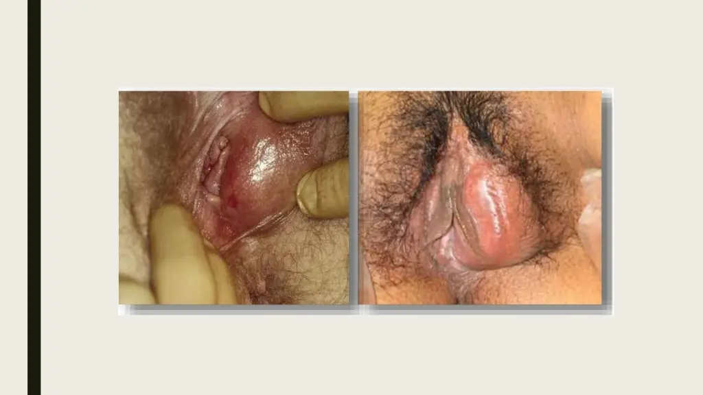 slide3