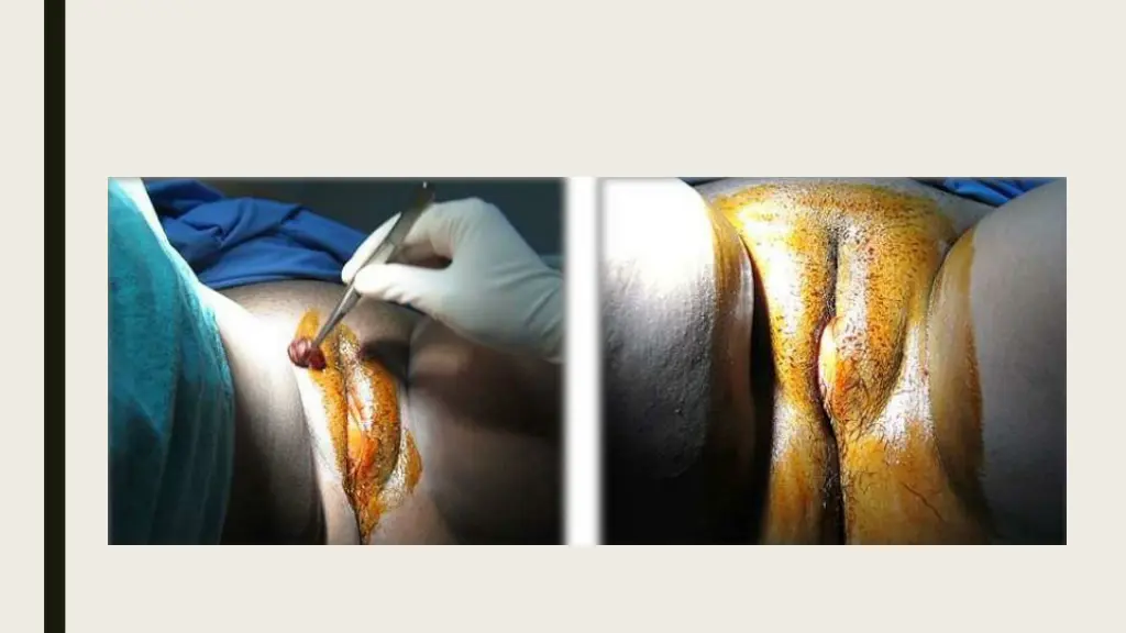 slide9