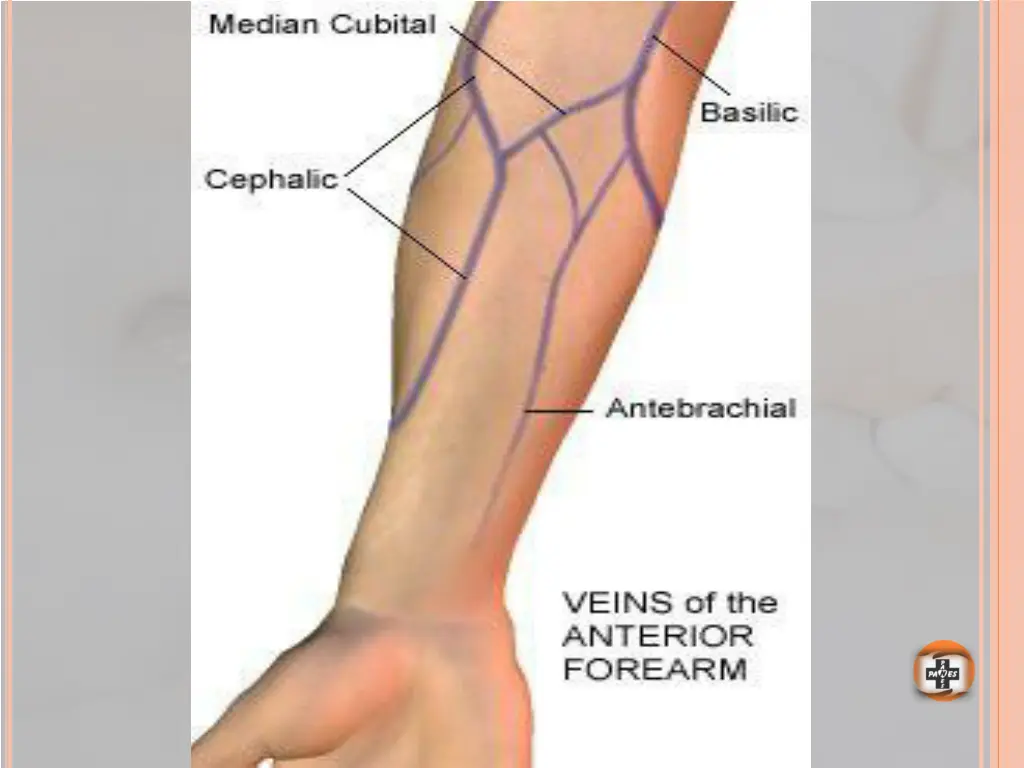 slide18