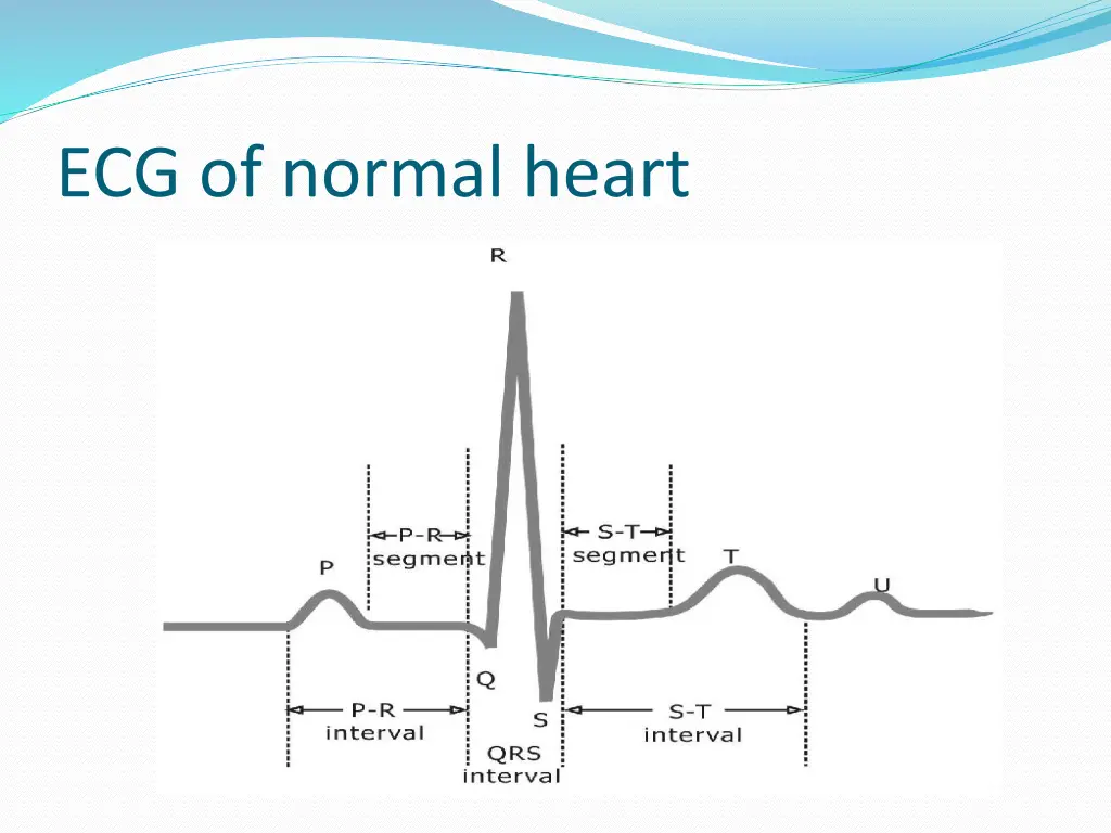 ecg of normal heart
