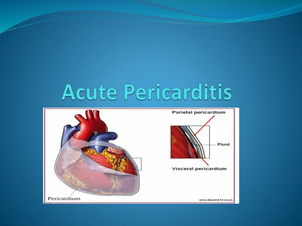 slide17