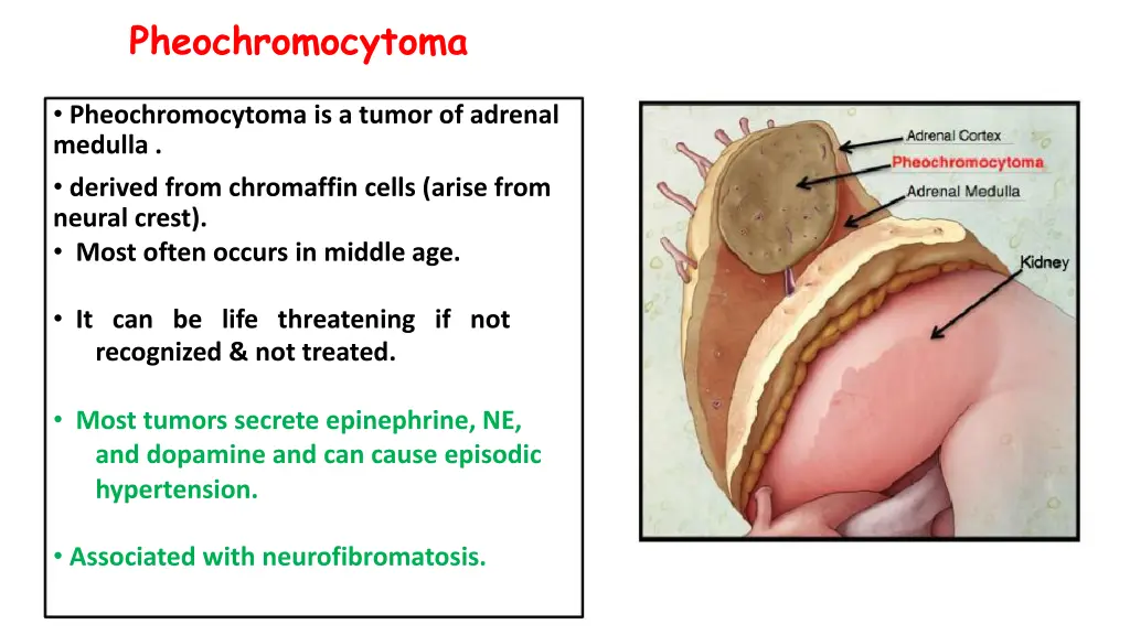 pheochromocytoma