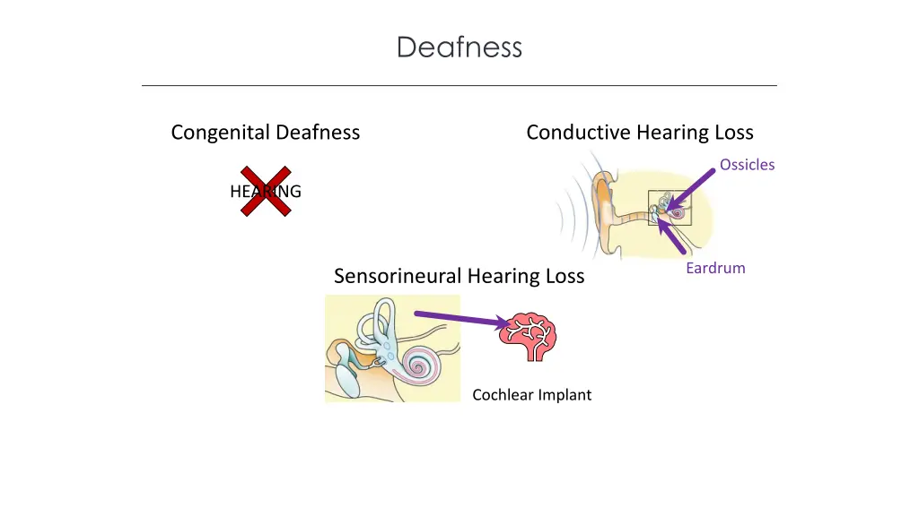 deafness