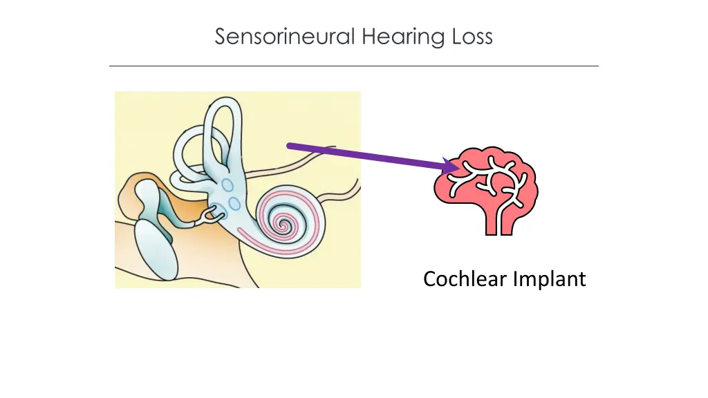 sensorineural hearing loss