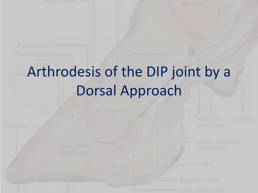 arthrodesis of the dip joint by a dorsal approach