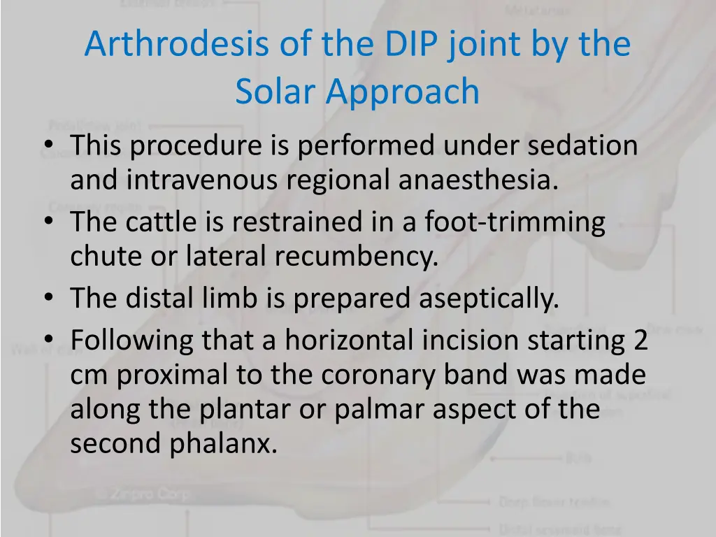 arthrodesis of the dip joint by the solar