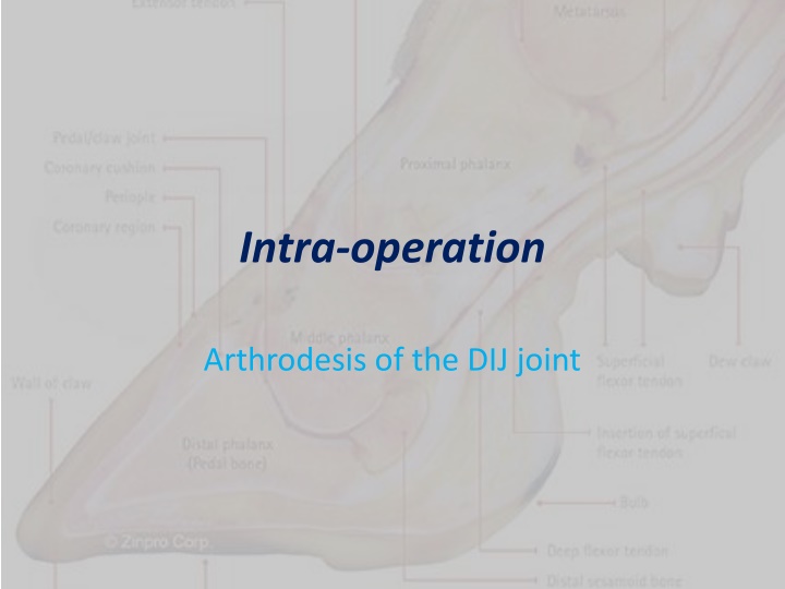 intra operation