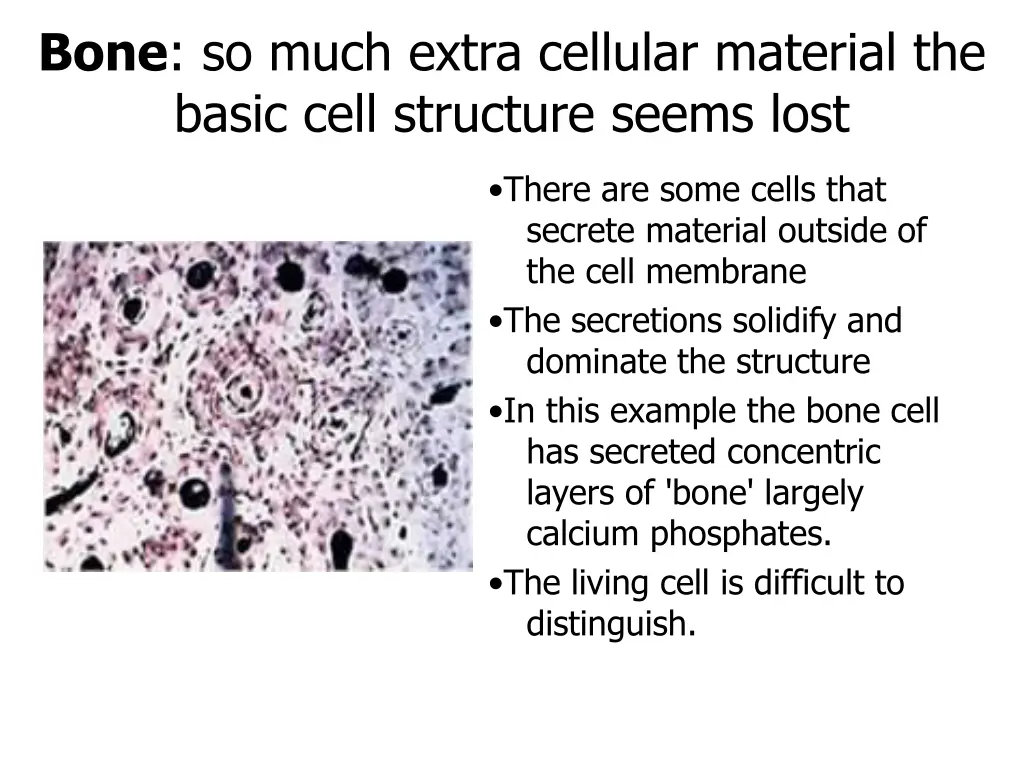 bone so much extra cellular material the basic