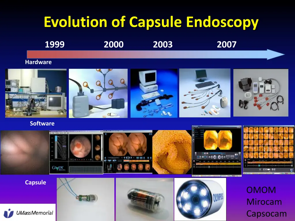 evolution of capsule endoscopy