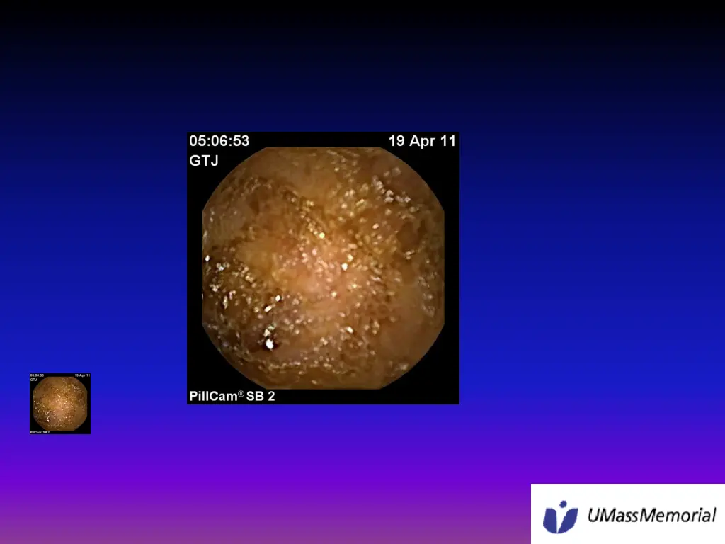 slide13