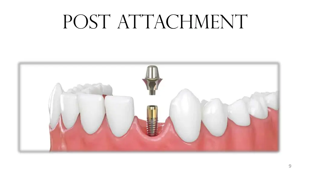 post attachment