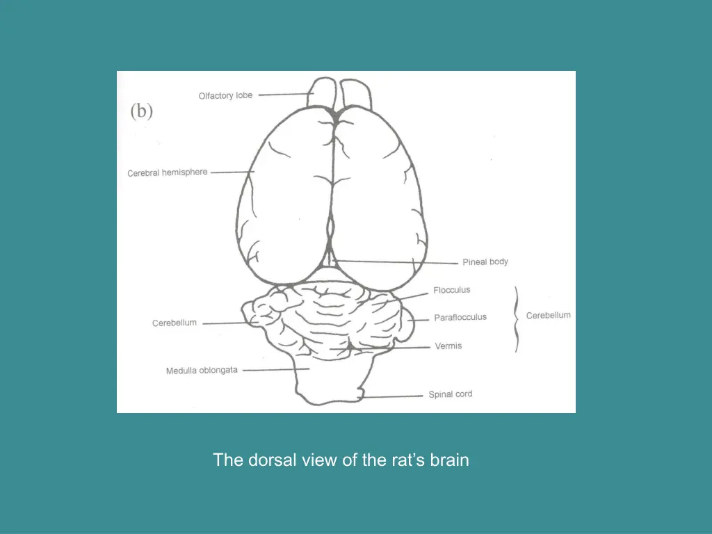 the dorsal view of the rat s brain