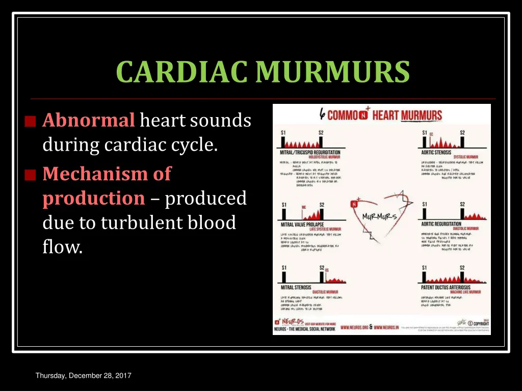 cardiacmurmurs