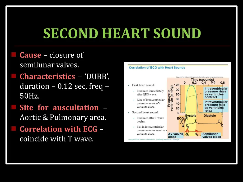 second heart sound
