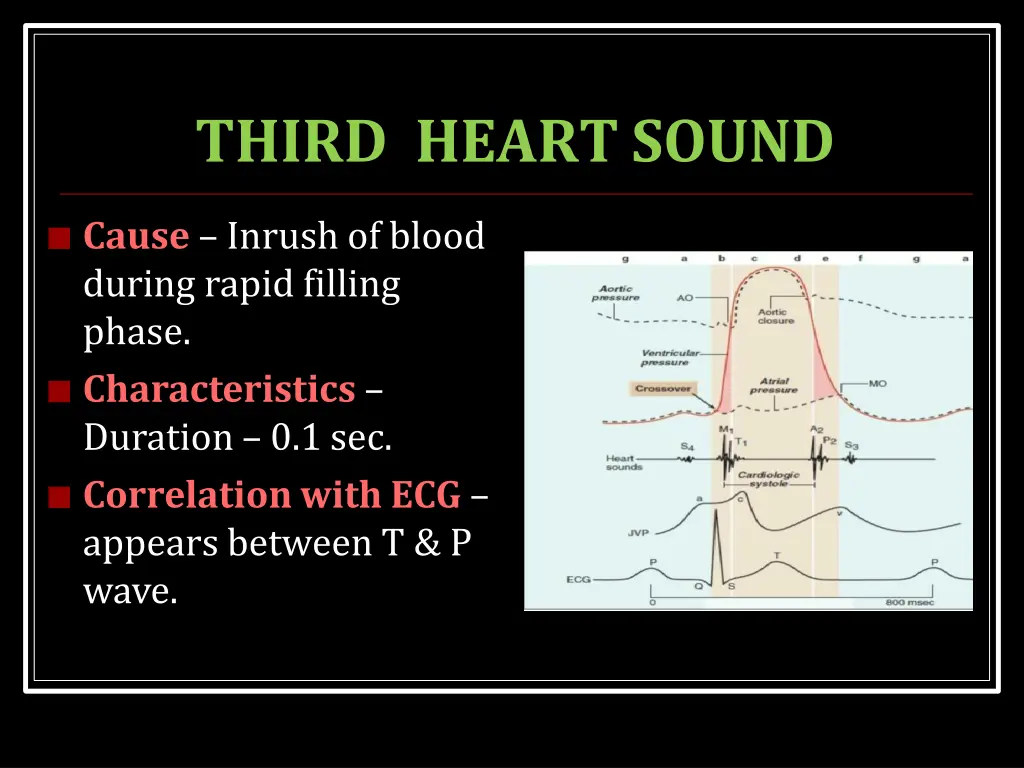 third heartsound