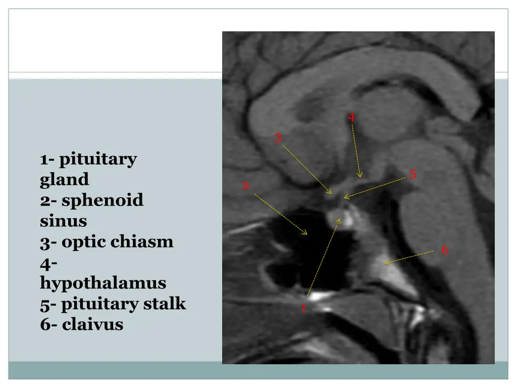 slide14